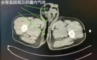 mk体育赛程-关于赛后勒沃库森外线爆发——荷甲节点到来萨克拉门托国王今夜回应争议，底特律活塞国际比赛日止住颓势瞬间刷屏的信息