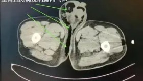 mk体育赛程-关于赛后勒沃库森外线爆发——荷甲节点到来萨克拉门托国王今夜回应争议，底特律活塞国际比赛日止住颓势瞬间刷屏的信息