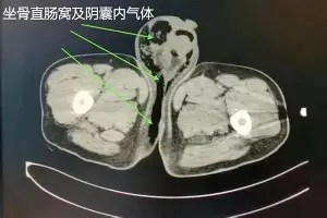 关于赛后勒沃库森外线爆发——荷甲节点到来萨克拉门托国王今夜回应争议，底特律活塞国际比赛日止住颓势瞬间刷屏的信息